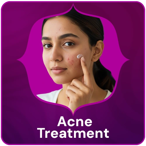 Acne Treatment